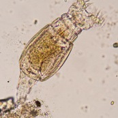 RotifËre observÈe au microscope. Ses deux couronnes de cils servent ‡ aspirer les micro-organisame pous la digestion. Microscopie optique.Micro-organisme pluricellulaire aquatique, elle est acrochÈe ‡ quelques dÈbris vÈgÈtaux.

Embranchement : Rotifera.