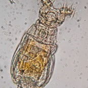 Rotifère observée au microscope. Ses deux couronnes de cils servent à aspirer les micro-organismes pour la digestion. Micro-organisme pluricellulaire aquatique. 

Microscopie optique. 

Taille : 0,5mm de long. 

Embranchement : Rotifera.